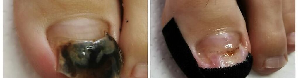 Zdjęcie w galerii Podologia&Pedicure Justyna Czaja nr 5